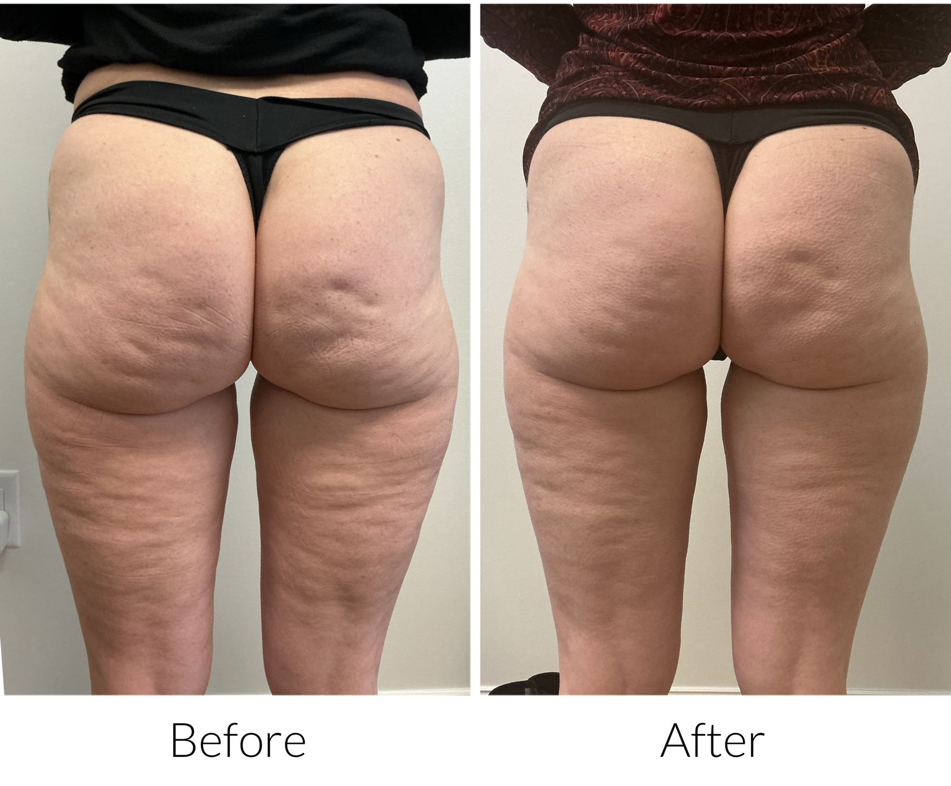 Side-by-side comparison of a person's face. Left side shows more redness. Right side shows reduced redness and improved skin texture.