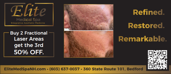 Advertisement for Elite Medical Spa: before/after laser treatment photos. 