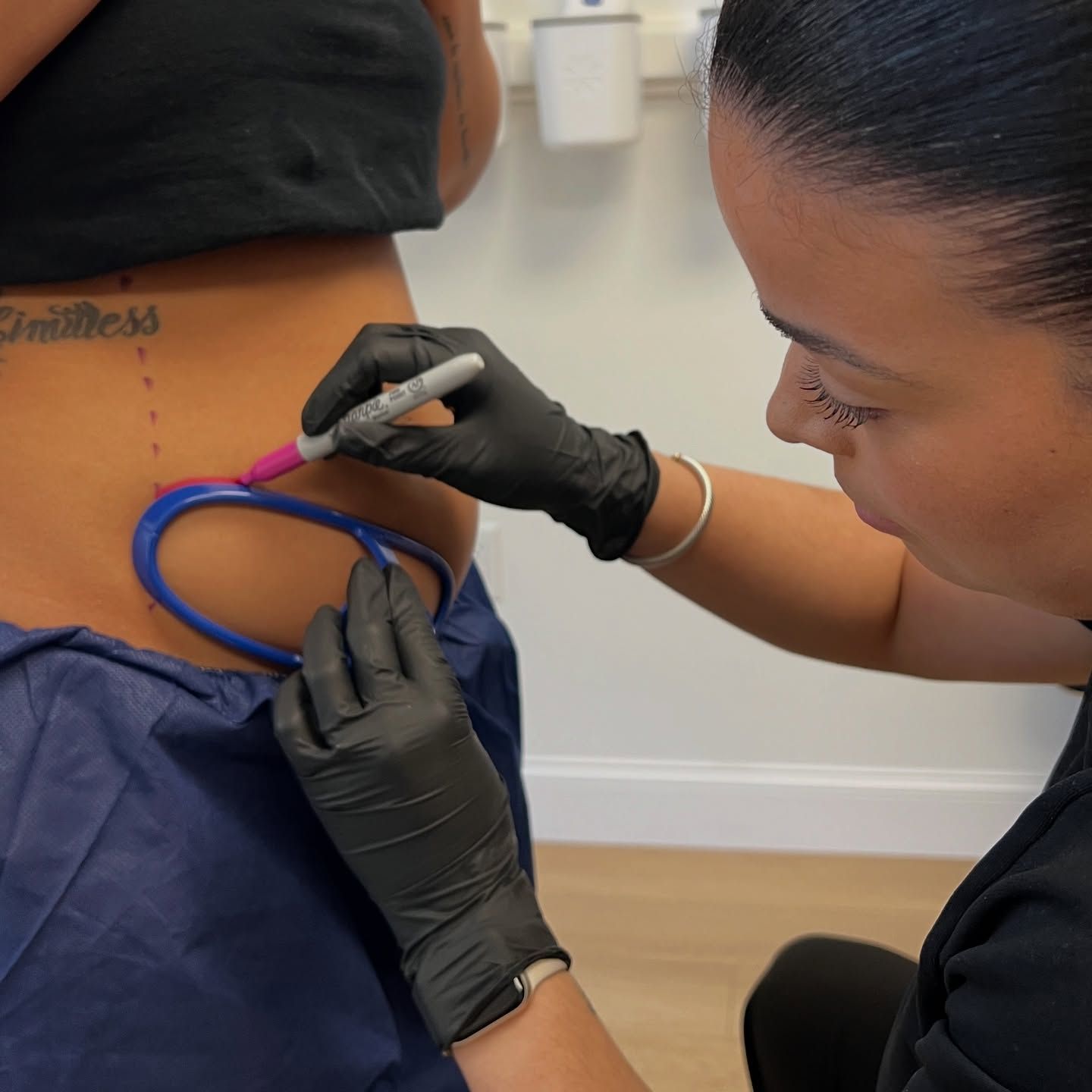 Person's side being marked with a marker, while a blue tool is used for outlining. Black gloves are worn.