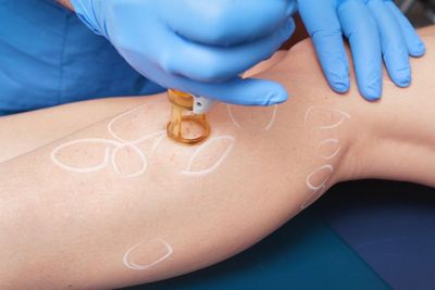 Cosmetic injector applying treatment to a woman’s cheek with a handheld device
