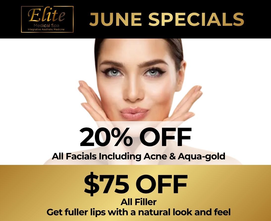 June specials promo: 20% off facials and $75 off filler, with a woman’s face on a gold-and-black ad