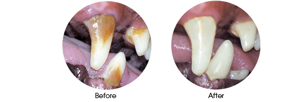 Before and After dental procedure