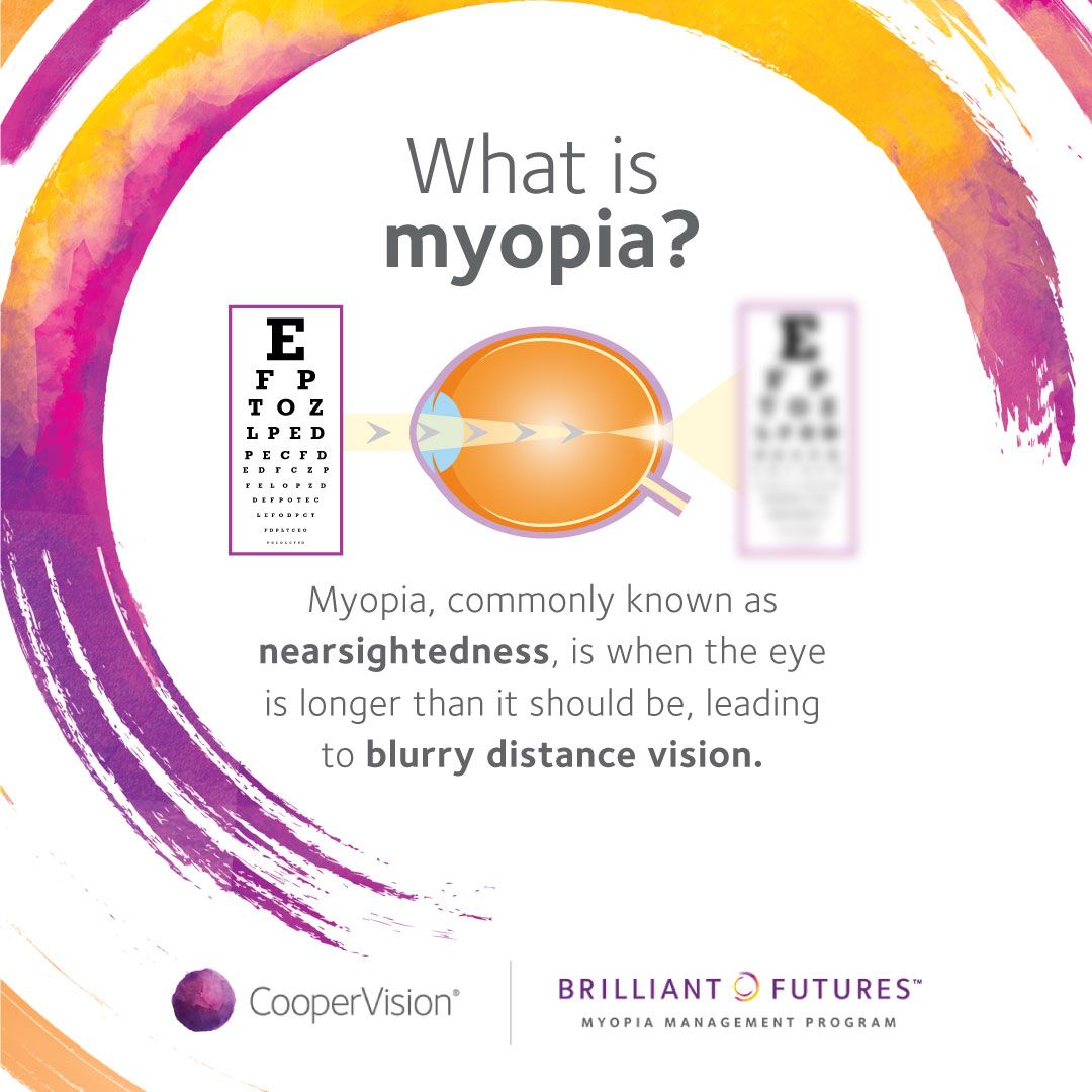 Myopia eye issue infographic