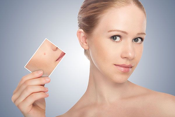 A woman is holding a picture of her face with a spot on it.