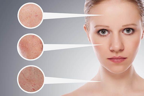 A close up of a woman 's face with three different types of skin.