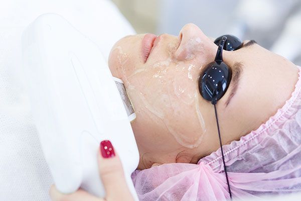 A woman is getting a laser treatment on her face.