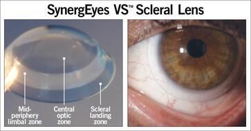 A picture of a contact lens and a picture of a person 's eye.