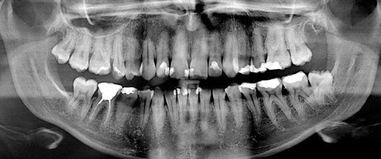 Dental diagnose