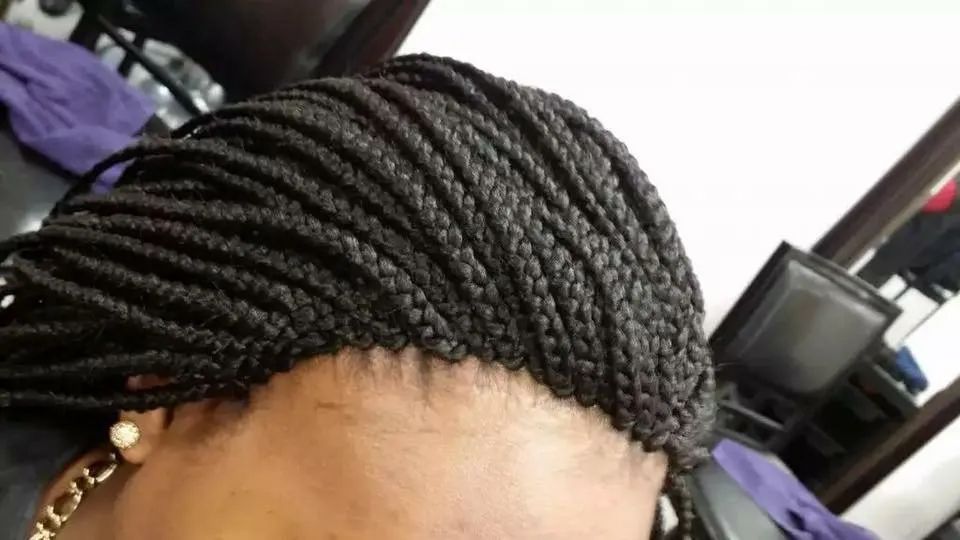 Close-up of a woman's head with black box braids, showing the braided hairline and scalp.