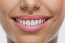 Teeth Whitening