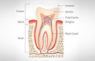 root canal