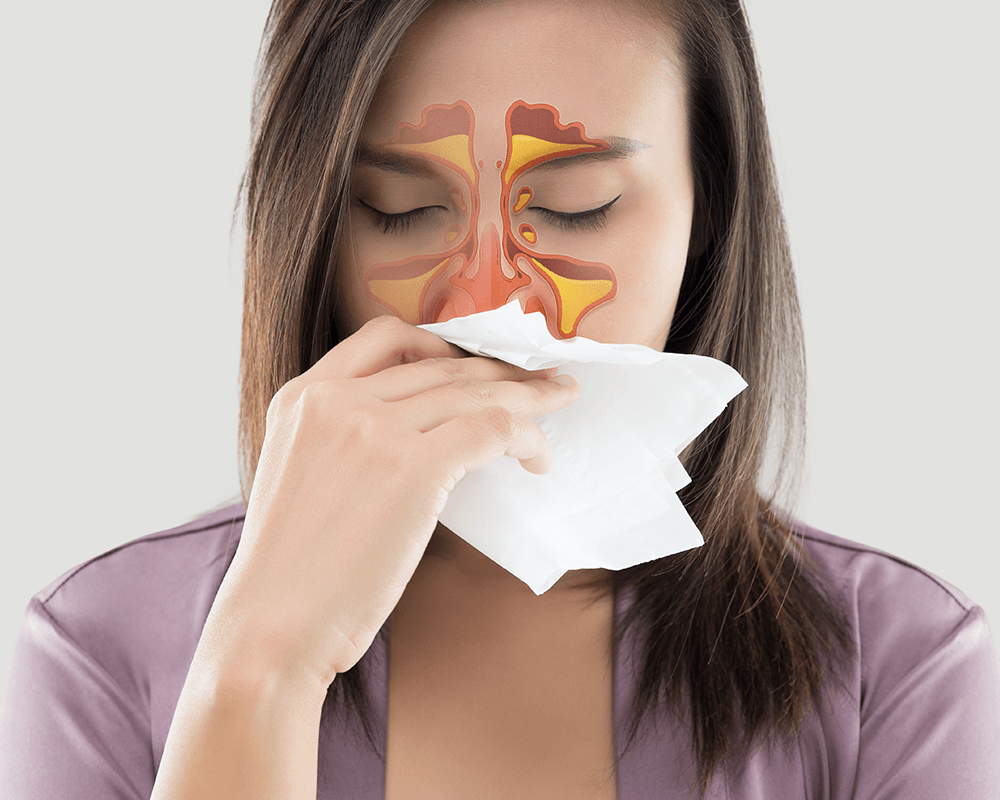 Sinus