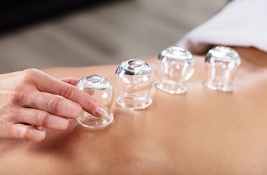 A person is getting cupping treatment on their back.