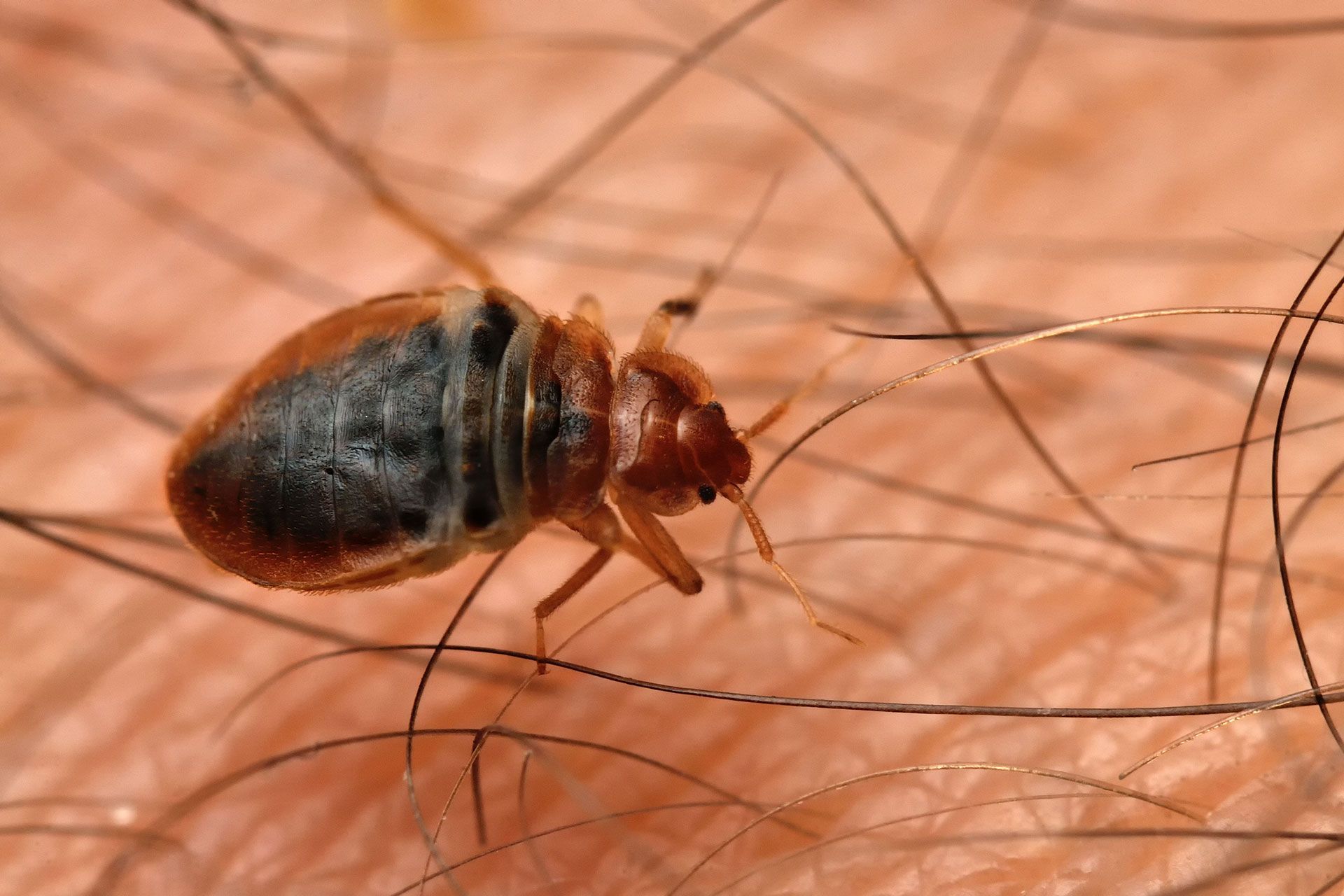 A bed bug is crawling on a person's hair