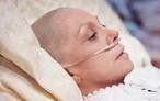 A woman with cancer is laying in a hospital bed with an oxygen tube in her nose.