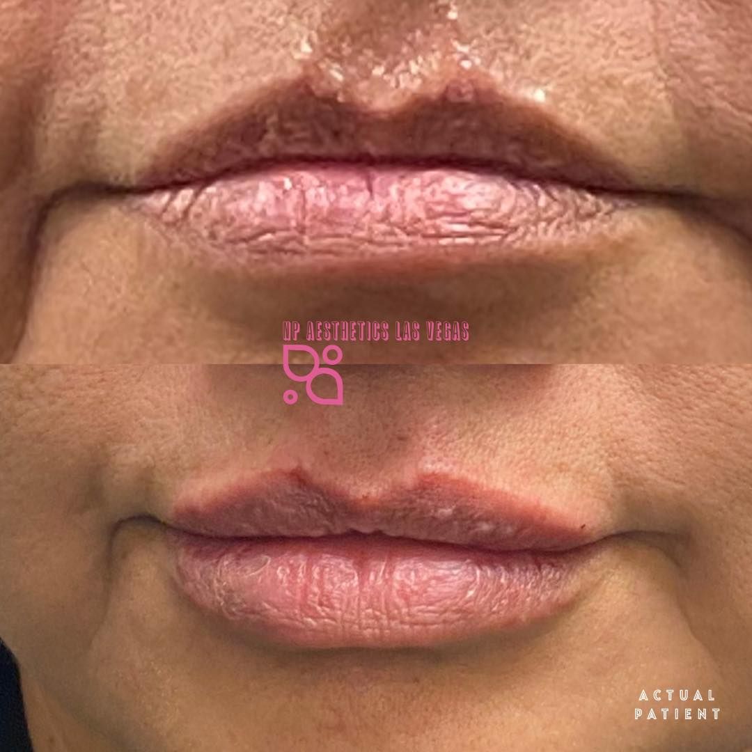 A close up of a woman 's lips with pink lipstick.