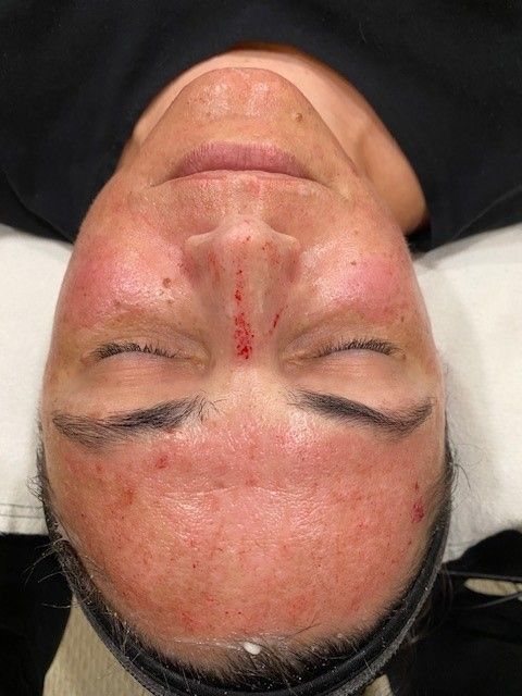 A close up of a woman's face with her eyes closed.