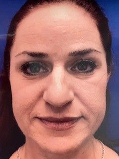 A close up of a woman's face with a blue background.