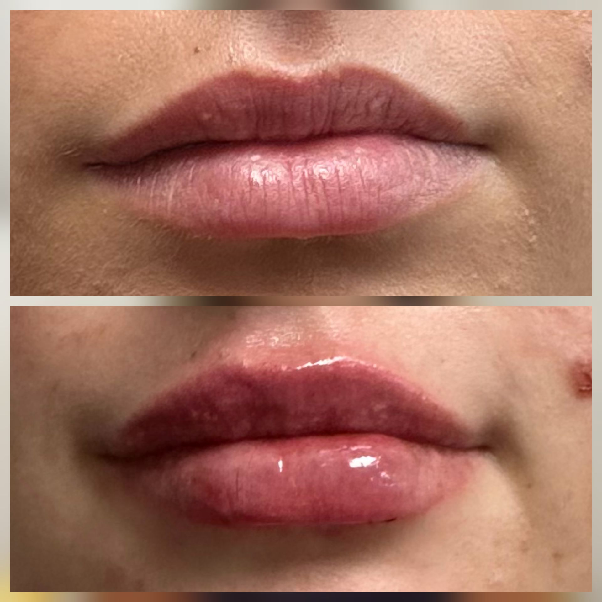 Two close-up lip photos: top natural pink lips, bottom glossy dark red lipstick on lips