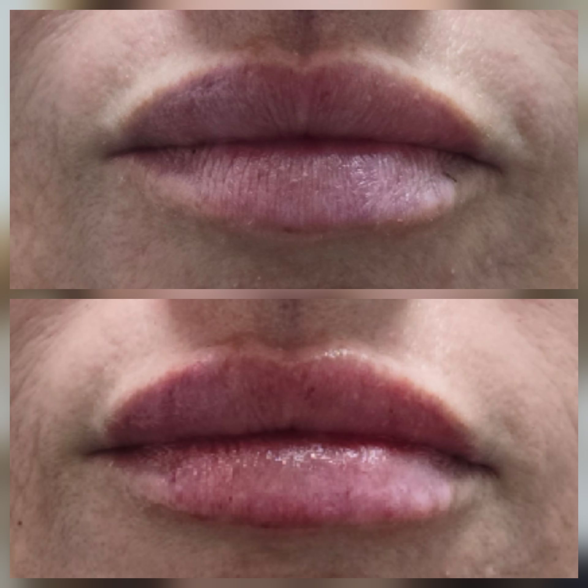 Close-up of lips, with the bottom lips appearing redder and more swollen than the top.