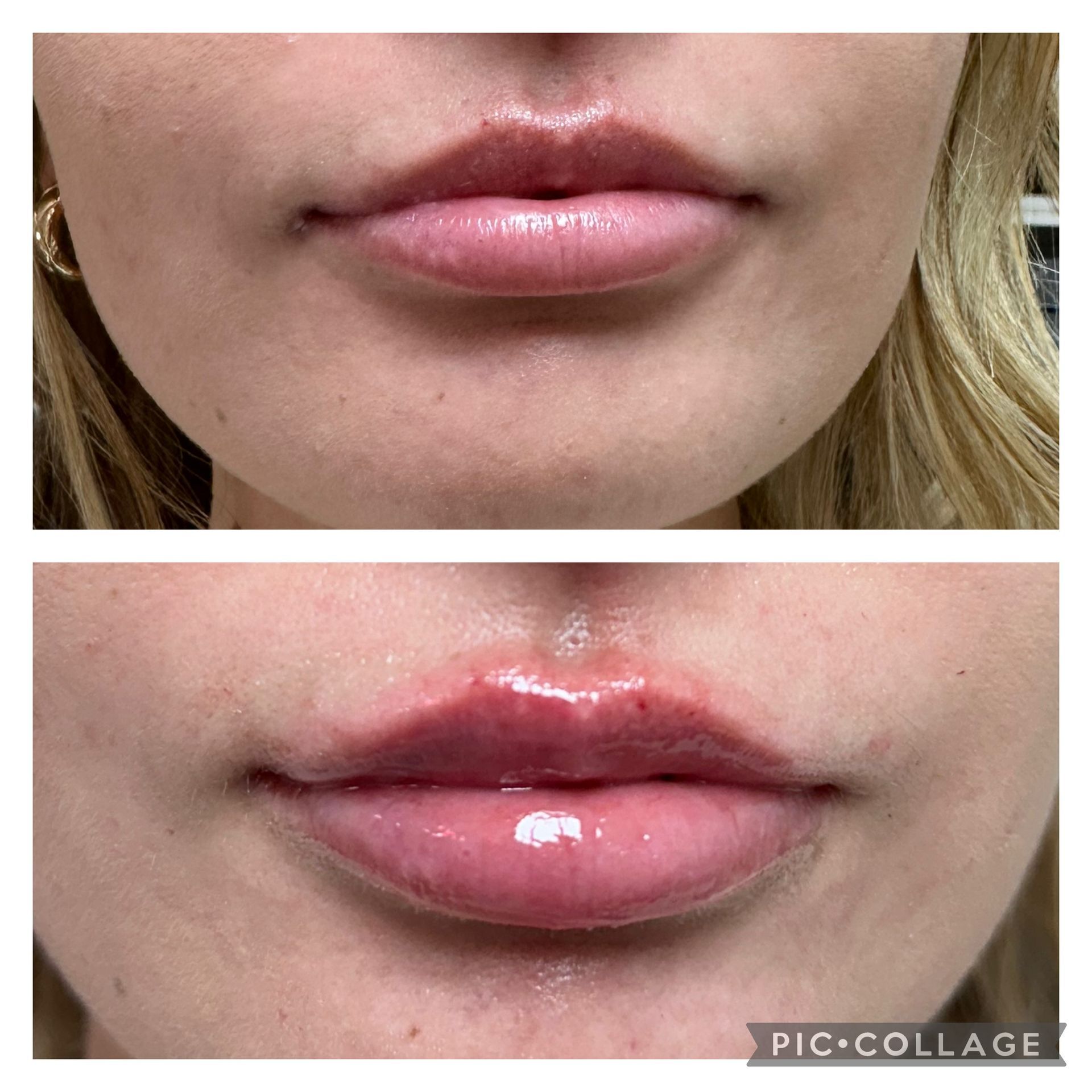 Side-by-side close-up of lips: natural, then glossy pink lipstick with a small upper lip blemish
