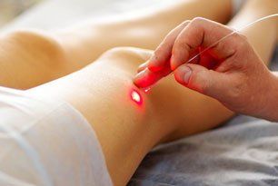 Cold laser acupuncture