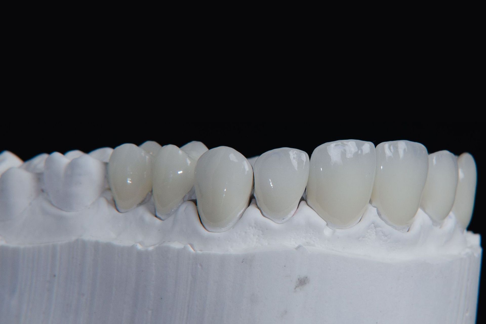 Dental prosthetic teeth on a white model base