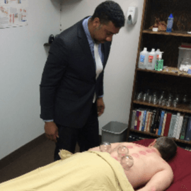 Cupping