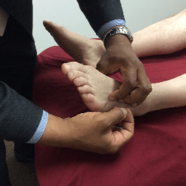 Acupuncture