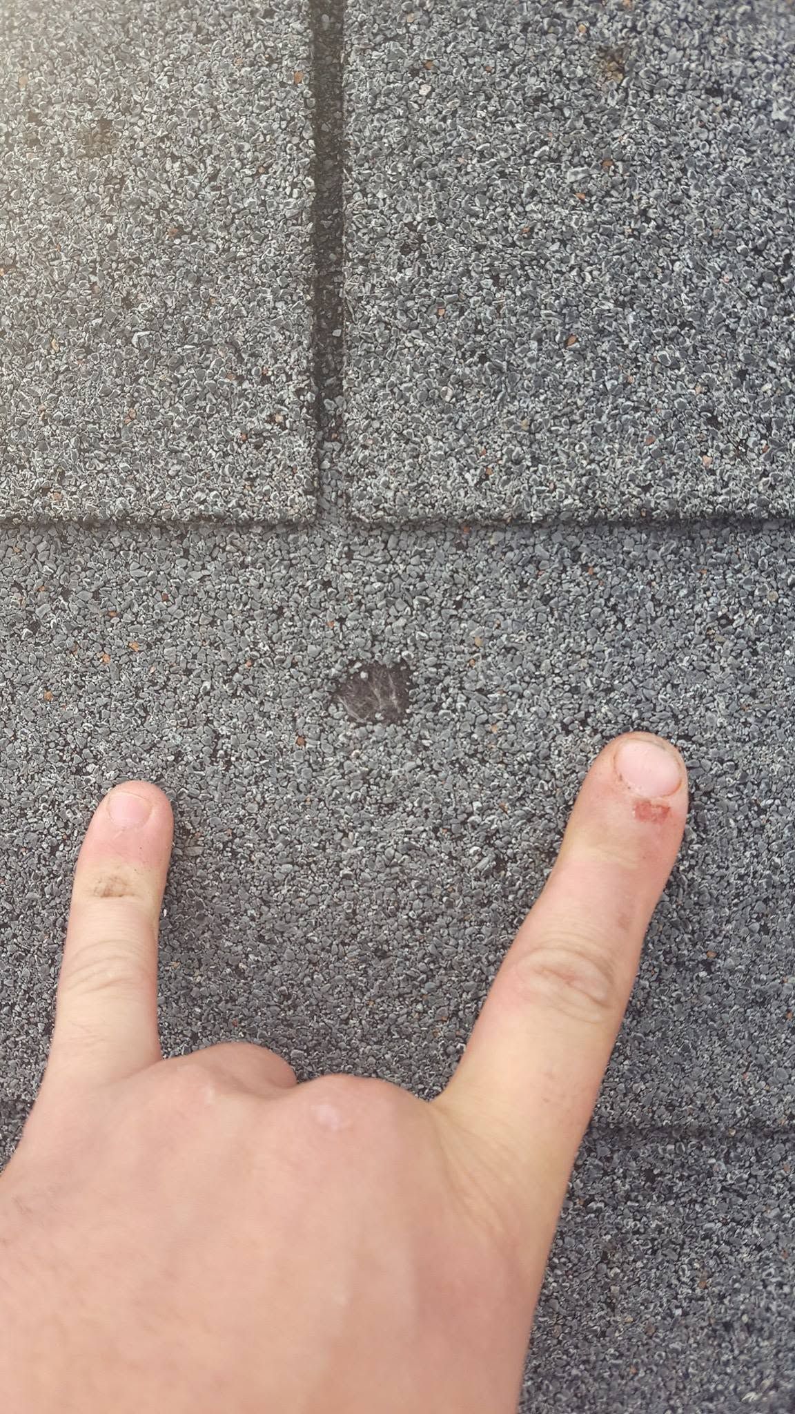Two fingers pointing at a gray shingled roof with a small dark spot near the center.