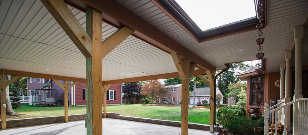 Wooden carport with a white ceiling, green grass, and houses in the background.