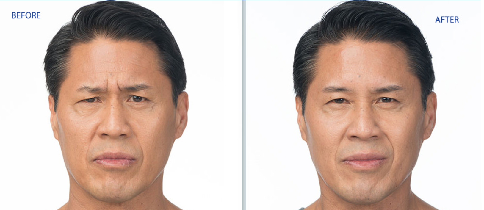 Before-and-after portrait showing a man's face with smoother skin and a slight smile after retouching.