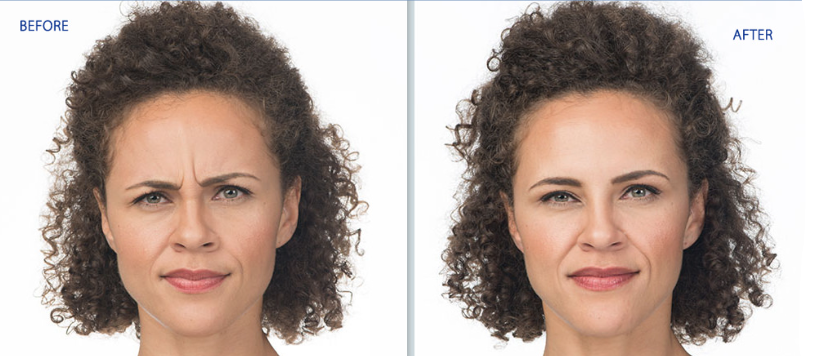 Side-by-side before and after face photos, with a frowning expression changing to a slight smile.
