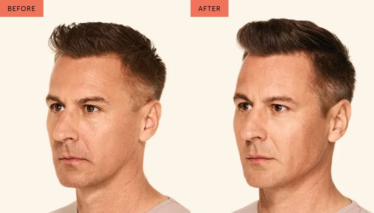 Side-by-side before-and-after headshots of the same man with a subtle haircut change on a beige background