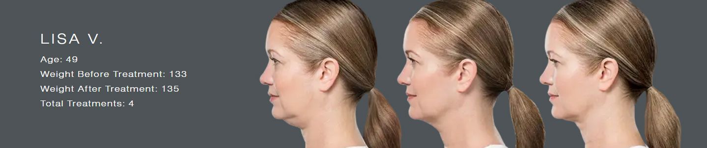 Three side-profile headshots of a blonde woman with short hair on a dark background, showing subtle hair changes.