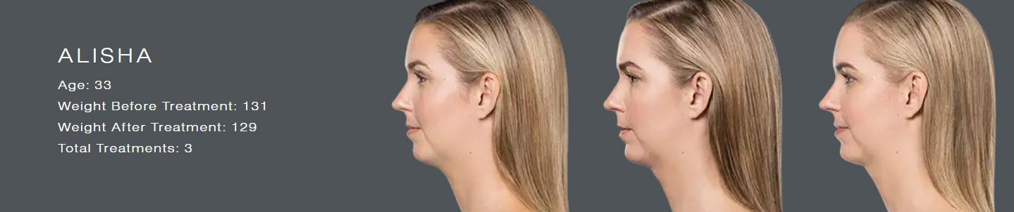 Three side-profile headshots of a blonde woman with short hair on a dark background, showing subtle hair changes.
