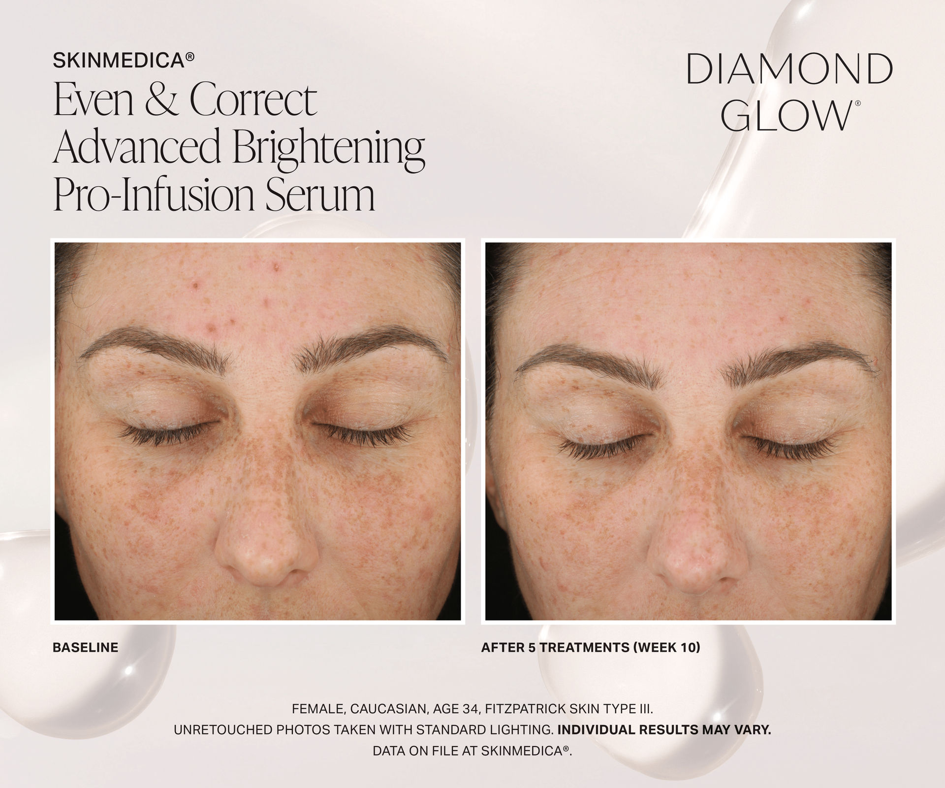 A before and after photo of a woman's face using diamondglow