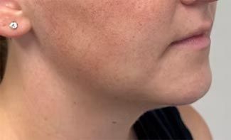 A close up of a woman 's face with earrings on.