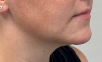 A close up of a woman 's neck and chin.