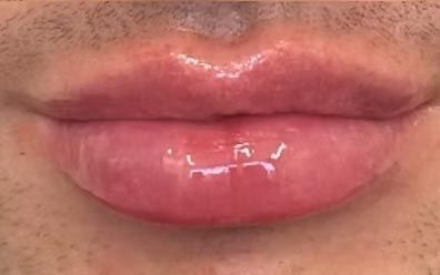 A close up of a person 's lips with a lot of gloss on them.
