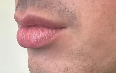 A close up of a man 's lips with a beard.