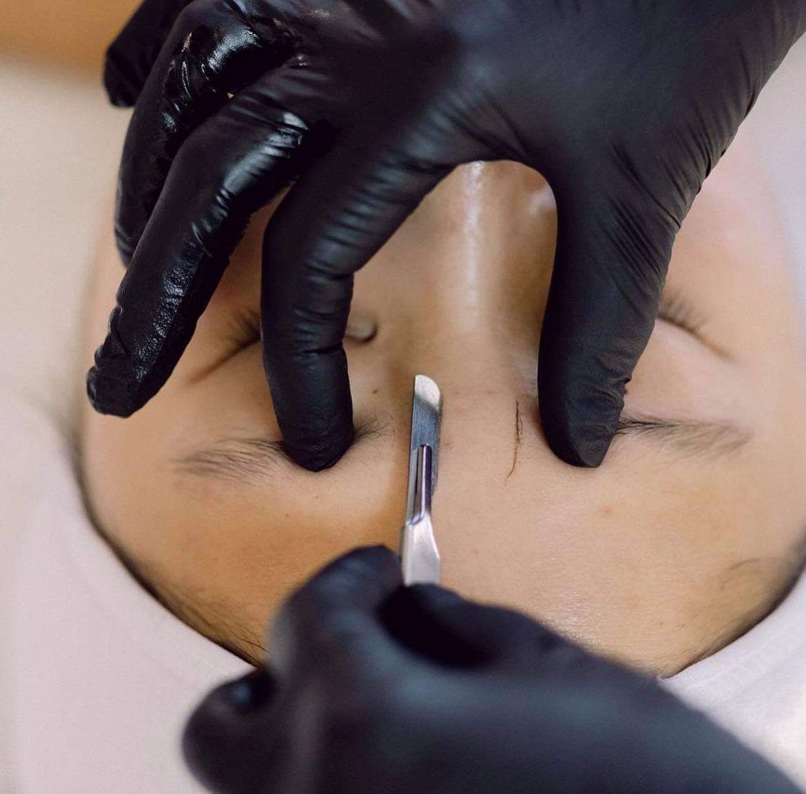 Dermaplaning service