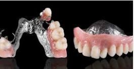 Dentures & Partials