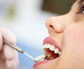 Patient with her mouth open