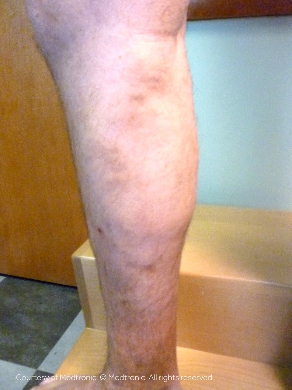 A close up of a person 's leg with stairs in the background