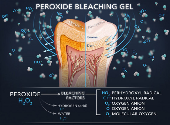 Peroxide bleaching