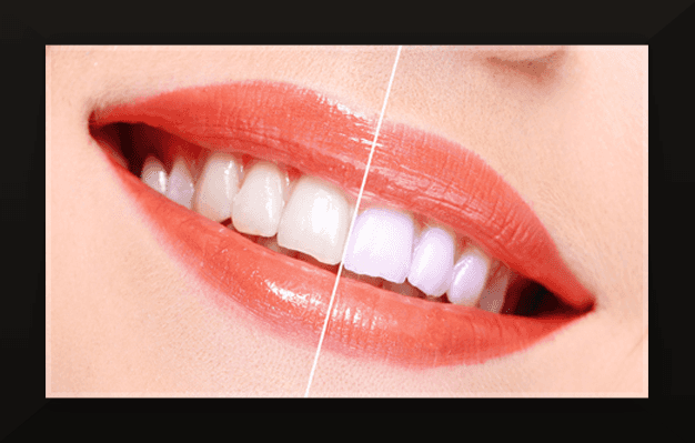 Cosmetic Dentistry | Pleasantville, NY | Nina Capretta, DMD | 914-769-1255