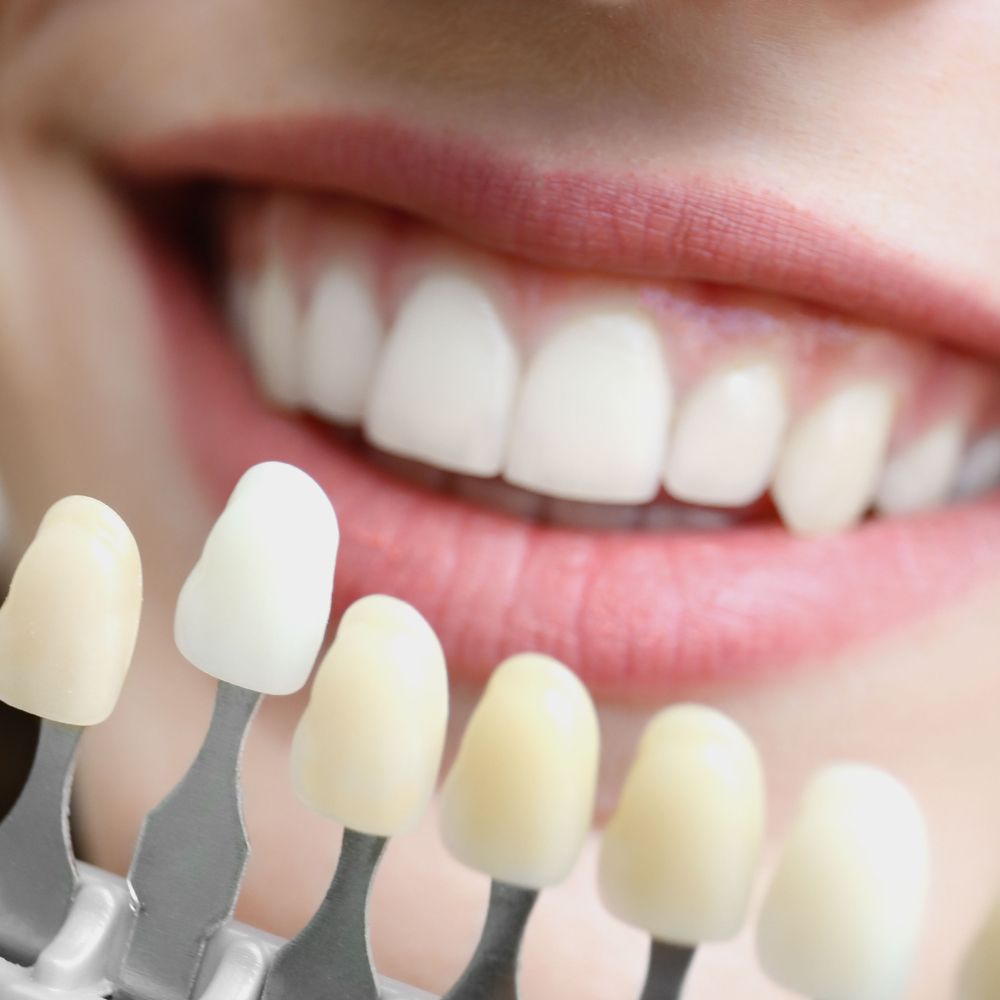 Cosmetic dentistry