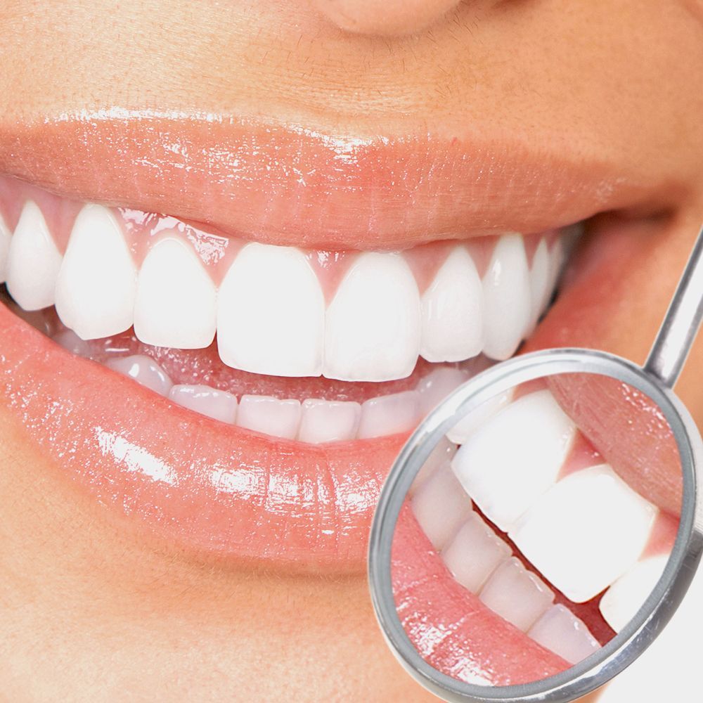 Beautiful teeth
