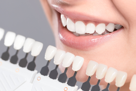 A close up of a woman 's teeth with a tooth color chart.